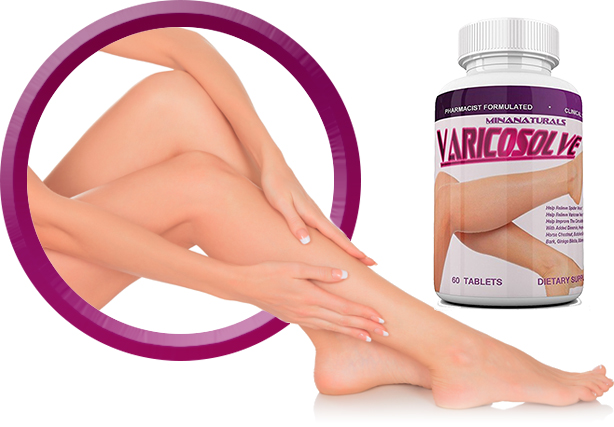 Varicosolve ngăn ngừa và hỗ trợ điều trị giãn tĩnh mạch chân