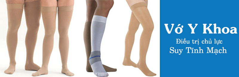 Sử dụng Vớ y khoa là cách điều trị giãn tĩnh mạch chân phổ biến